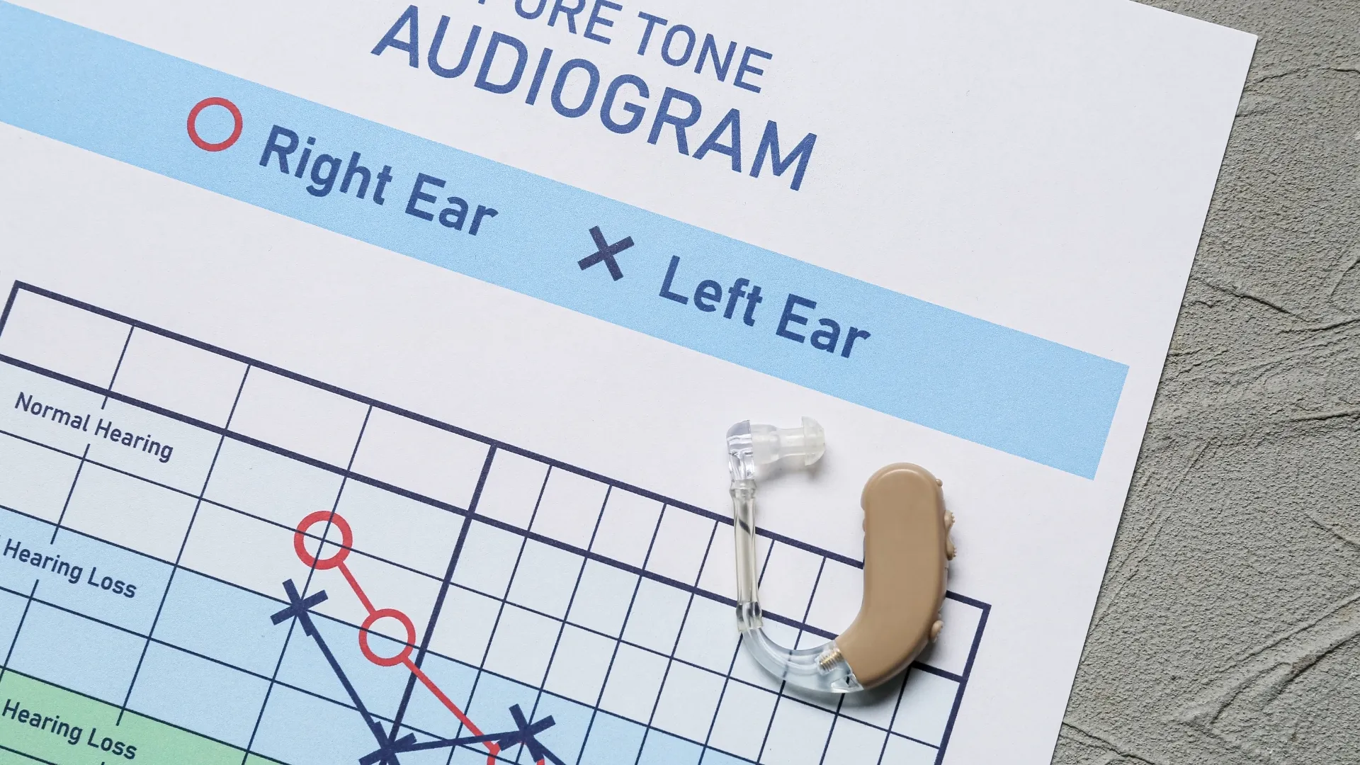 Featured image for “What Your Hearing Evaluation Results Really Mean”